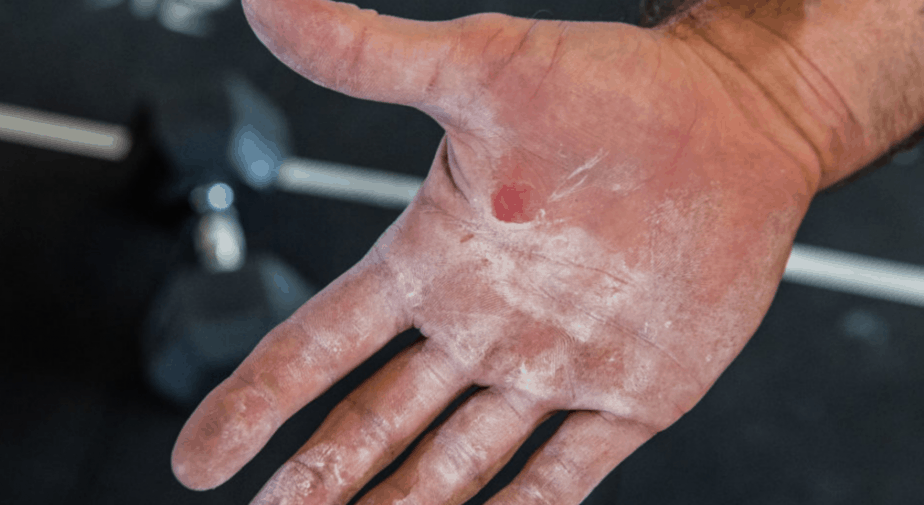 crossfit hand tear skincare guide 