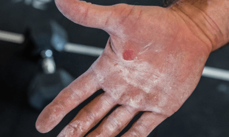 crossfit hand tear skincare guide