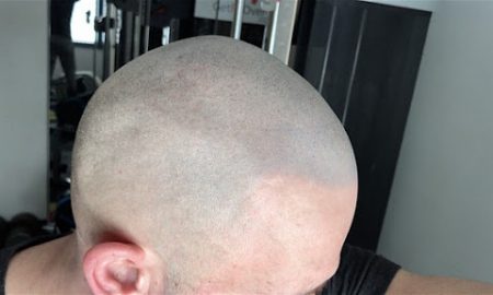 bald crossfitter micropigmentation