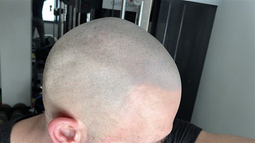 bald crossfitter micropigmentation