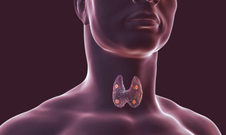 throat Hyperparathyroidism