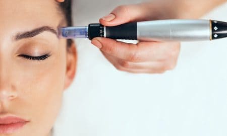 Microneedling A Guide to Rejuvenating Your Complexi